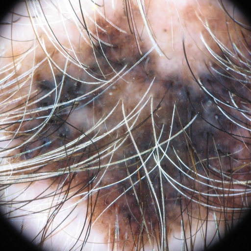 Segmentation of people in the photo