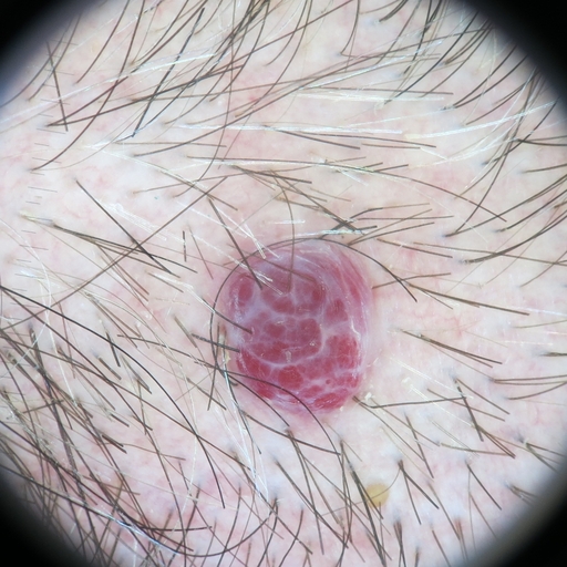 Segmentation of people in the photo