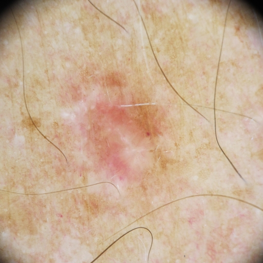 Segmentation of people in the photo