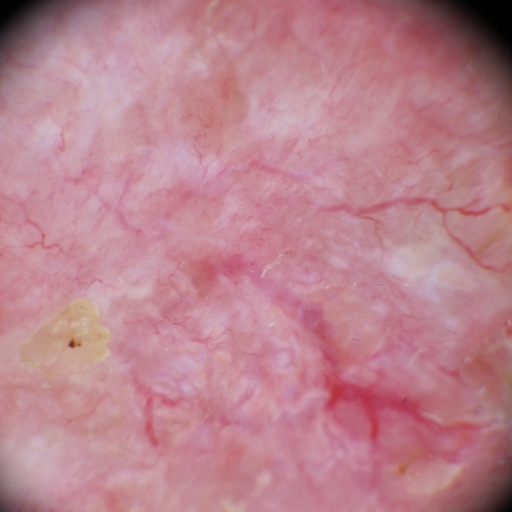 Segmentation of people in the photo