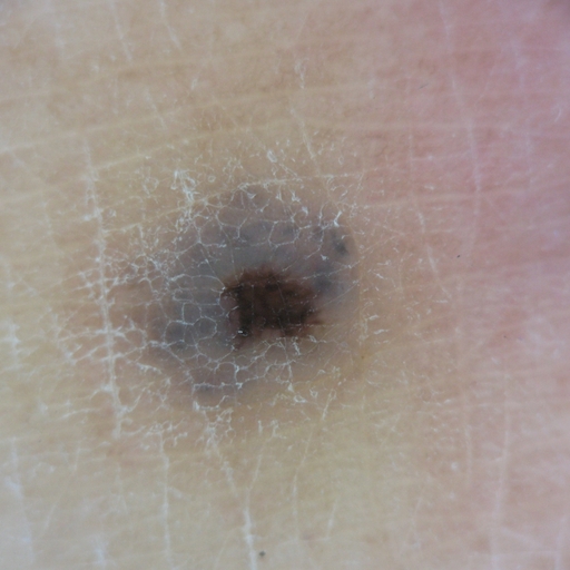 Segmentation of people in the photo