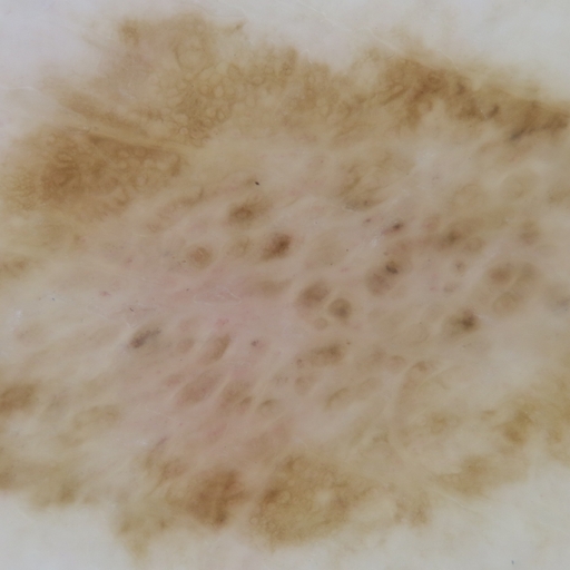 Segmentation of people in the photo