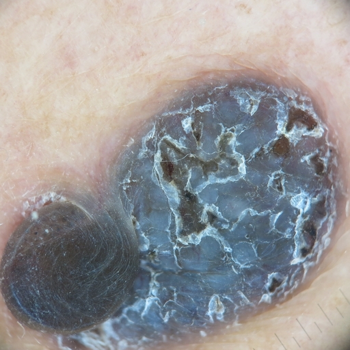 Segmentation of people in the photo