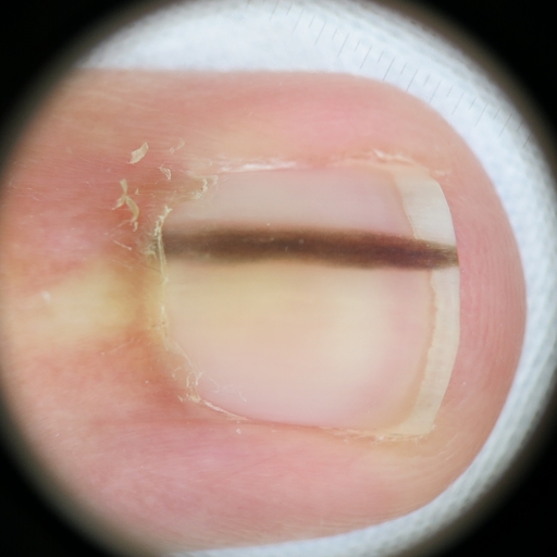 Segmentation of people in the photo