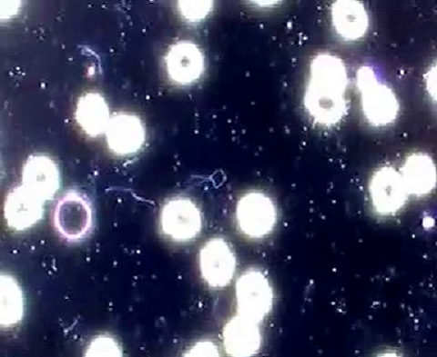 Segmentation of people in the photo