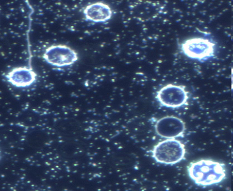 Segmentation of people in the photo