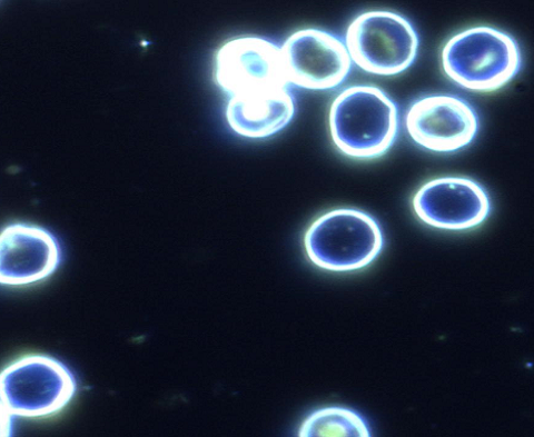 Segmentation of people in the photo