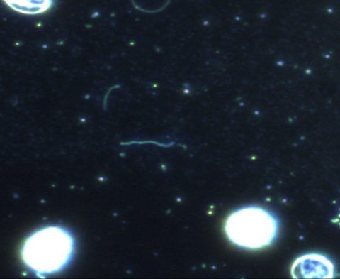 Segmentation of people in the photo